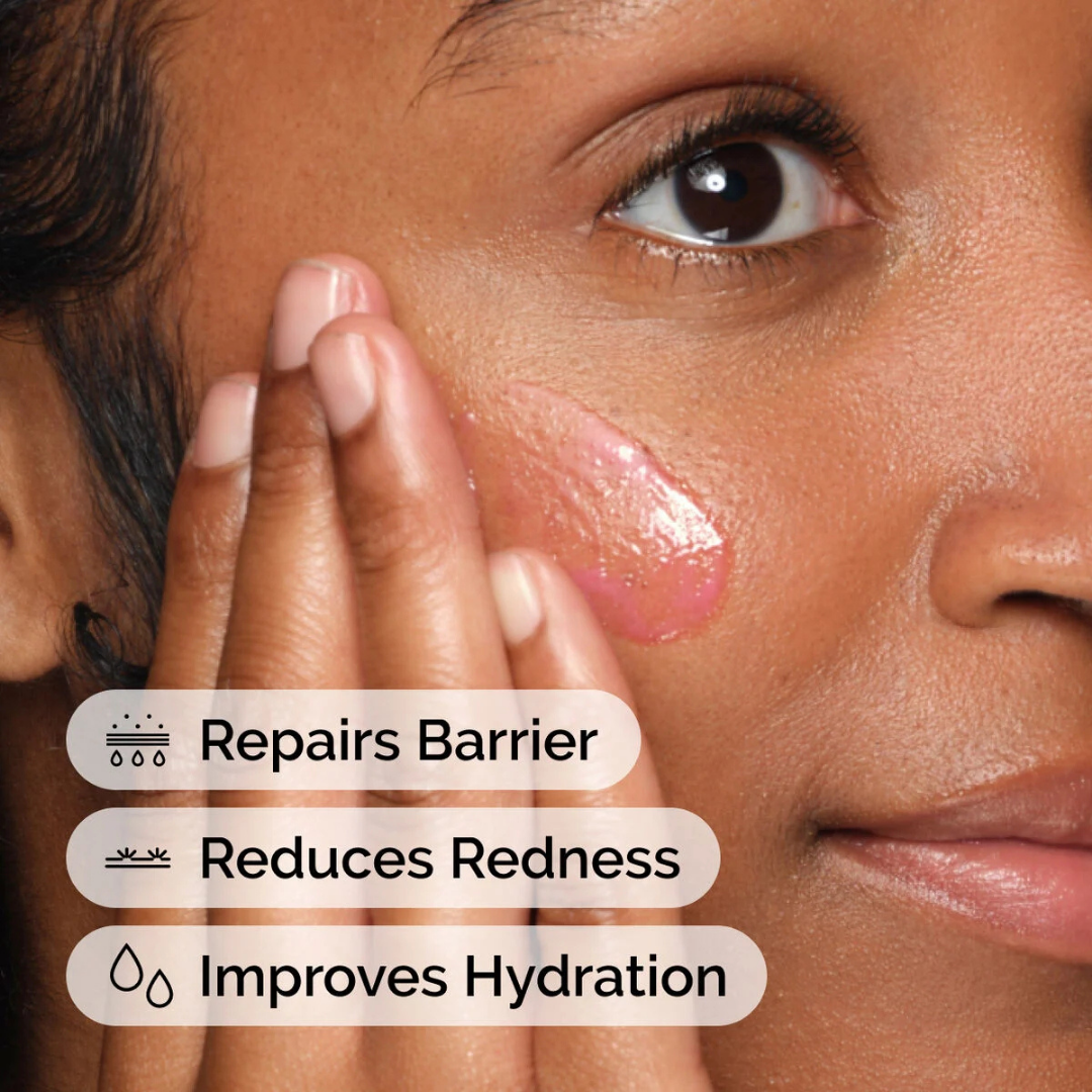 Soothing & Barrier Support Serum (15ml)