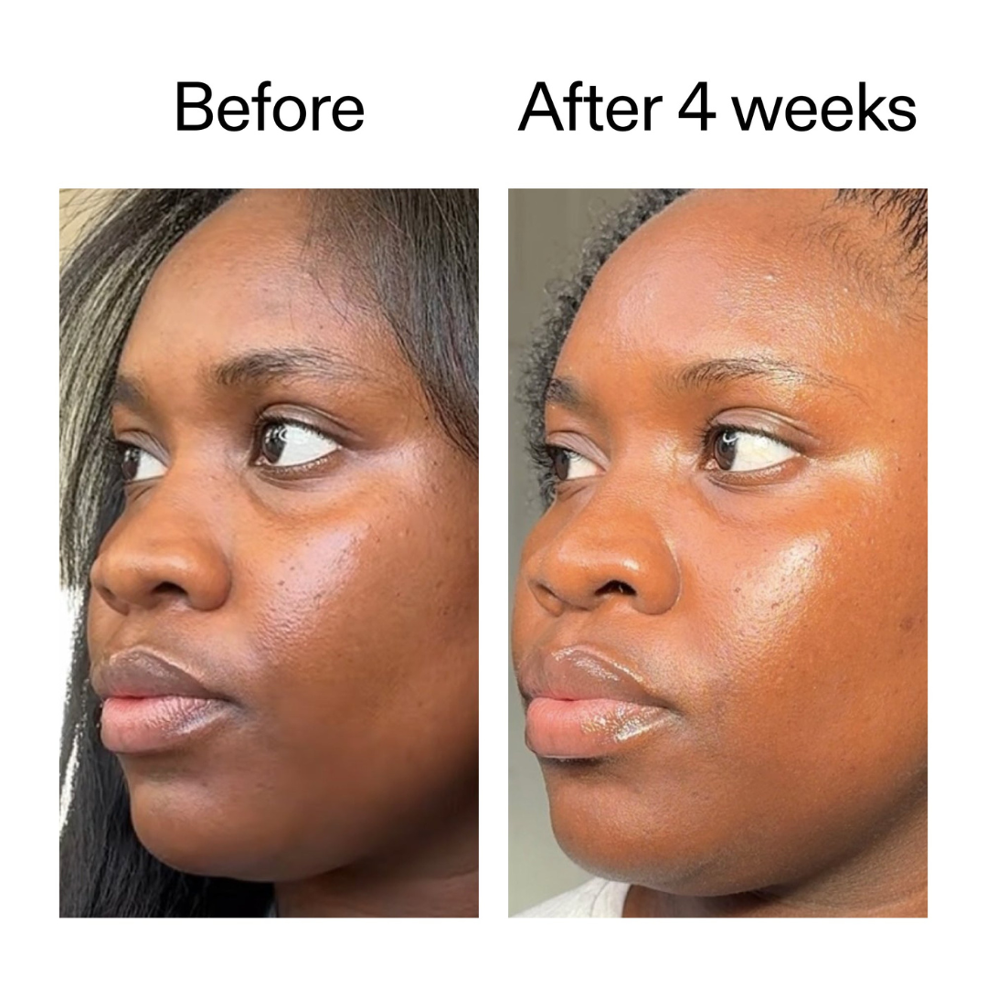 The Inkey List Exosome Hydro-Glow Complex Serum